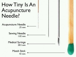 acupunctuur naalden acupunctuur praktijk tilburg